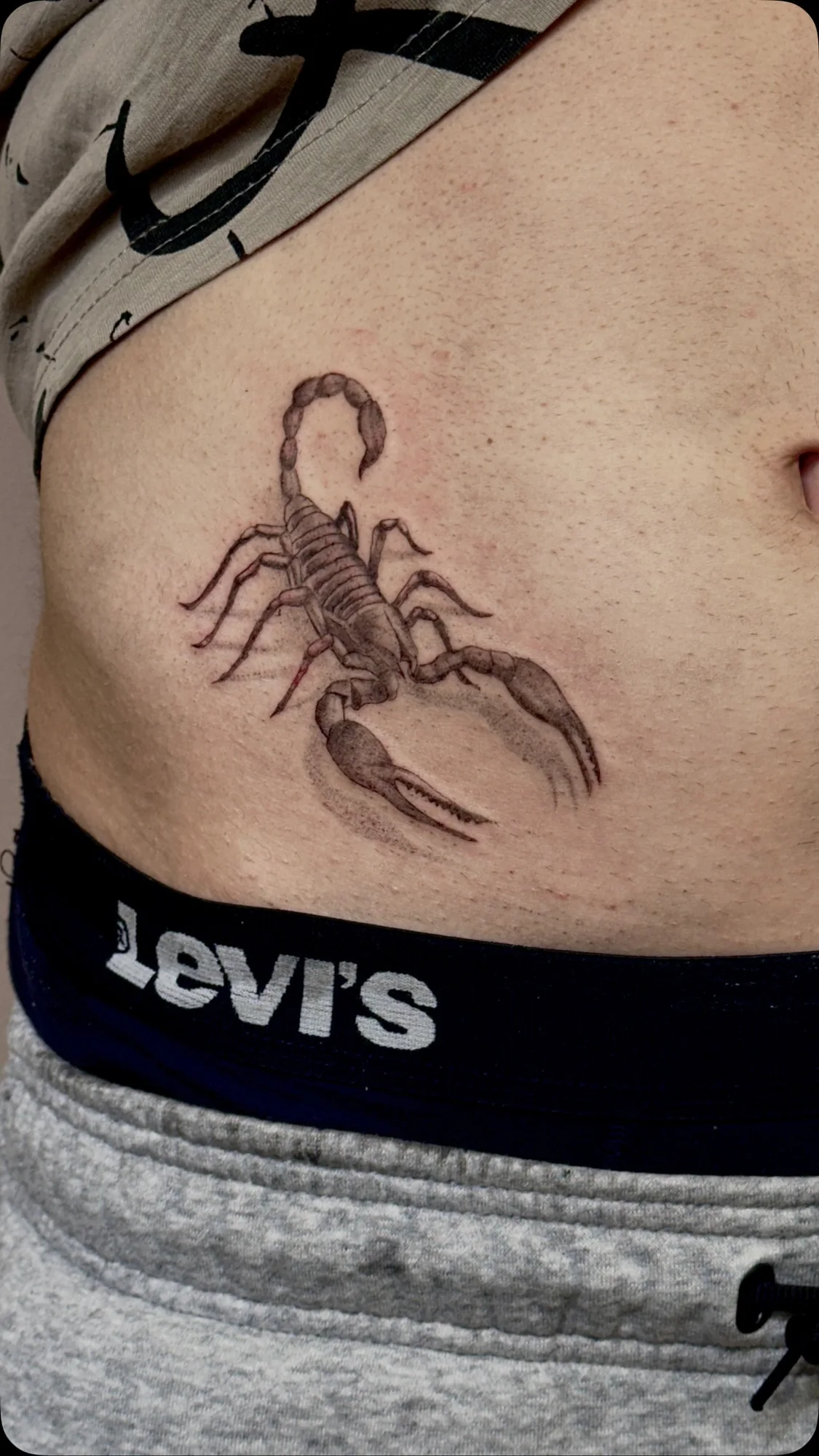 Tatuaggio blackwork di uno scorpione